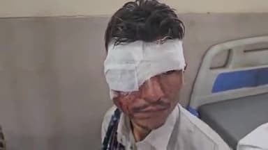 पीपलदा: इटावा इलाके में तेज रफ्तार मोटरसाइकिल देर रात भेस से टकराई, 2 युवक घायल, MBS अस्पताल में भर्ती, उपचार जारी