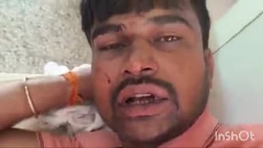 रायबरेली: शिवमंगल खेड़ा में पालतू कुत्ते के भौंकने पर दबंगों ने युवक पर किया हमला, युवक को जिला अस्पताल किया गया रेफर