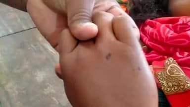 सांप के काटने से महिला की हुई दर्दनाक मौत! महिला सोशिला देवी नरेशगढ़ प्रखंड लातेहार की निवासी है! #latehar #snake_bite