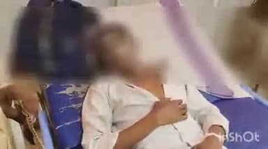 फिरोज़ाबाद: उर्दू नगर में बारात में चला पटाखा छत पर देख रहे युवक के चेहरे से टकराकर फटा, युवक बुरी तरह झुलसा