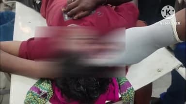 गिरिडीह: ताराटांड़ थाना क्षेत्र के जोधपुर निवासी व्यक्ति सड़क हादसे में घायल, सदर अस्पताल में इलाज जारी