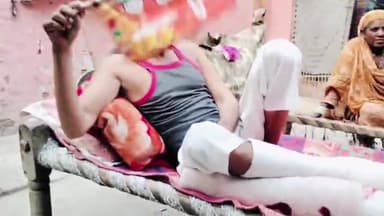 बड़ौत: गंगनौली गांव में बंदरों व आवारा कुत्तों का आतंक, 100 साल की बुजुर्ग महिला सहित कई लोग घायल #jansamasya