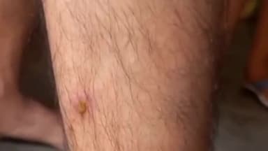 धनौरा: मंडी धनौरा तहसील क्षेत्र में बढ़ा आवारा कुत्तों का आतंक, शहरी लोग हैं परेशान #jansamasya