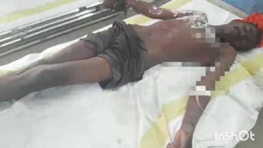 अरवल: औरंगाबाद से ससुराल आए युवक को बिजली के करंट से लगी चोट, सदर अस्पताल में कराया गया इलाज