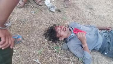 प्रभात पट्टन: गोधनी रोड पर अज्ञात वाहन चालक ने बाइक सवार युवक को टक्कर मारी, युवक गंभीर रूप से घायल, सामुदायिक अस्पताल में भर्ती