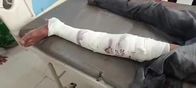 टीकमगढ़: मंजना गांव के समीप बोलेरो ने बाइक में मारी टक्कर, मामी-भांजे को आई चोट