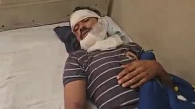 लाडपुरा: उद्योग नगर के रायपुरा में बाइक पर आवारा कुत्तों के झुंड ने किया हमला, बाइक फिसलने पर युवक घायल, MBS अस्पताल में भर्ती