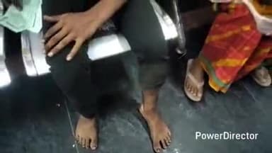 कटिहार: कटिहार के सिकटिया में खेत से घर लौटते समय नाबालिग को जहरीले सांप ने डंसा, इलाज के लिए हायर सेंटर रेफर, परिजन चिंतित