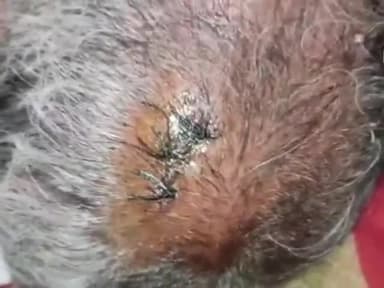 नौगावां सादात: नौगांवा थाना क्षेत्र के गांव नानक नगली में पानी भरने को लेकर हुआ विवाद, तीन घायल, 6 पर मुकदमा दर्ज, वीडियो हुआ वायरल