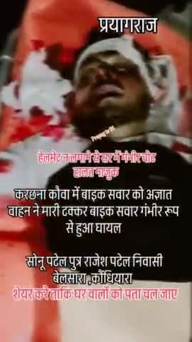 करछना: कौवा: बाइक सवार को अज्ञात वाहन ने मारा टक्कर गंभीर रूप से हुआ घायल