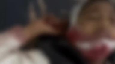 सेन्हा: सेन्हा मस्जिद के पास स्कॉर्पियो पेड़ से टकराई, एक बच्ची की मौत व 5 लोग घायल