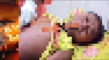 कलियासोल: कलियासोल के उरमा गांव में 8 वर्षीय बच्चे के हाथ में फटा मोबाइल, परिवार सदमे में, अस्पताल में इलाज जारी