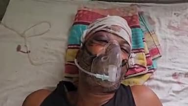 पीपलदा: इटावा गेता मार्ग पर 2 मोटरसाइकिल की टक्कर में एक शख्स गंभीर घायल, एमबीएस अस्पताल में भर्ती