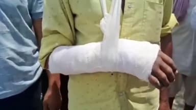 नसीराबाद: नसीराबाद के निकट गांव शोकलिया में जमीनी नापने के दौरान धारदार हथियार से हमला और मारपीट