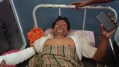 हसनपुर: रहरा गांव पथरा में 11 हजार वोल्टेज की लाइन ठीक कर रहा युवक झुलस गया, हालत गंभीर