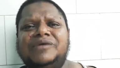 बलिया: मसूरचक में एक परिवार के तीन लोगों के साथ मारपीट की घटना