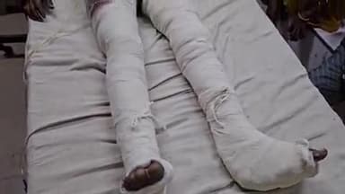 लाडपुरा: तालेड़ा-केशोरायपाटन मार्ग पर मोटरसाइकिल को कार ने मारी टक्कर, 2 घायल अस्पताल में भर्ती, उपचार जारी