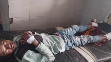 सिंगरौली: जयंत गोलाई छोटी बस्ती में मालगाड़ी की चपेट में आने से युवक गंभीर रूप से घायल, अस्पताल में इलाज जारी