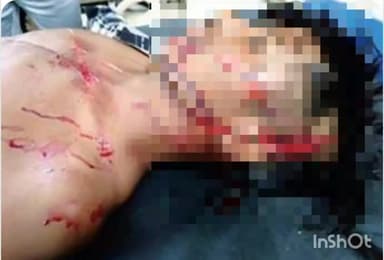 चितरंगी: सरई थाना क्षेत्र के पिपराडोल जंगल के पास बाइक और बोलेरो की टक्कर में एक युवक समेत 2 घायल, इलाज जारी