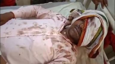 शिवपुरी नगर: काली पहाड़ी गांव में जमीनी विवाद को लेकर दो लोगों ने पति-पत्नी के साथ की मारपीट, घायल का जिला अस्पताल में उपचार जारी