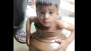 सागर नगर: चकराघाट वार्ड में खेलते समय पानी के बर्तन में फंसा 2 वर्षीय बच्चा, बर्तन को काटकर सकुशल निकाला गया बाहर