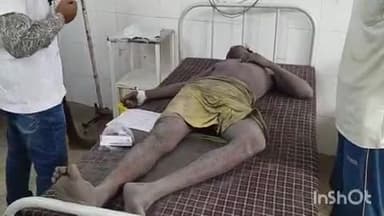 भभुआ: घोसा गांव में बिजली के खंभे से तार खींचते समय करंट की चपेट में आने से एक किसान झुलसा
