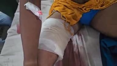 लाडपुरा: बोरखण्डी में रुपयों की लेन-देन को लेकर युवक पर फायरिंग और चाकू से ताबड़तोड़ हमला, घायल को MBS अस्पताल में भर्ती किया गया