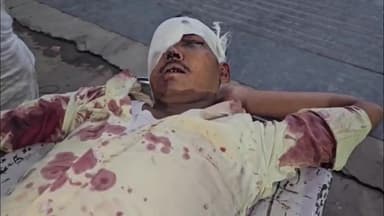 मझगंवा के समीप अज्ञात वाहन की टक्कर से बाइक सवार व्यक्ति हुआ घायल, रीवा किया गया रेफर