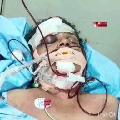 ಕಾರ್ಕಳ: ಪತಿಯಿಂದ ಪತ್ನಿಗೆ ಮಾರಣಾಂತಿಕ ಹಲ್ಲೆ ಗಂಭೀರ ಗಾಯಗೊಂಡ ಮಹಿಳೆ ಆಸ್ಪತ್ರೆಗೆ ದಾಖಲು