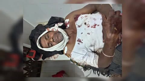किनवट: दयाल धानोरा येथील शेत शिवारात अस्वलाने केला 9 शेतकऱ्यांवर हल्ला; एकाचा मृत्यू, चौघांची प्रकृती गंभीर