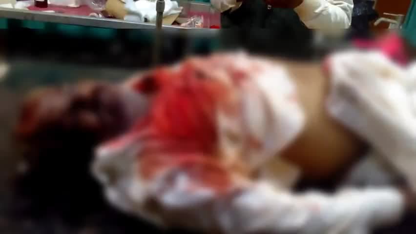नांगल राजावतान: आलुदा में अज्ञात वाहन की टक्कर से एक व्यक्ति की हुई मौत, हादसे के बाद मृतक के घर में शादी का माहौल मातम में बदला