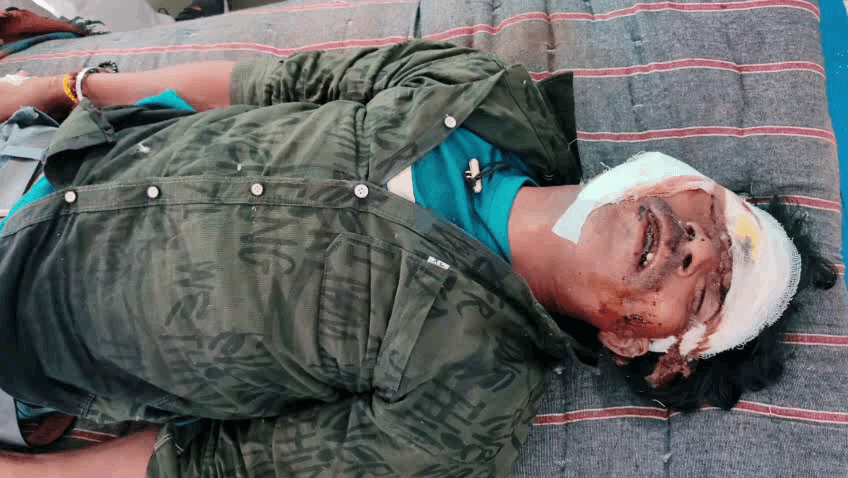 बजाग: बुधगांव में सड़क हादसे में युवक की मौत, कोतवाली पुलिस कर रही है अज्ञात की पहचान