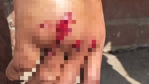 ডায়মন্ডহারবার ২: মানখণ্ড এলাকায় সাইকেল ও বাইকের সংঘর্ষে আহত সাইকেল আরোহী