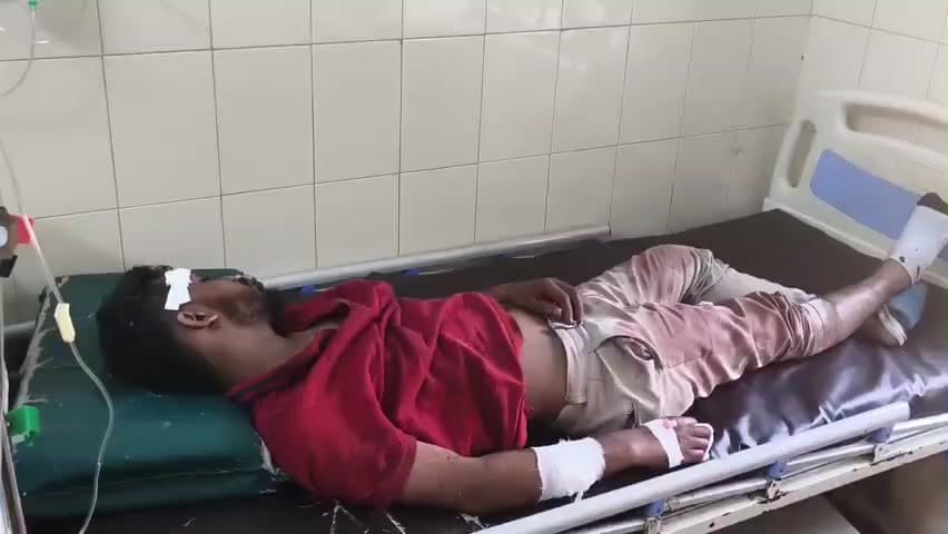 ತೀರ್ಥಹಳ್ಳಿ: ಆಲ್ಮನೆ ಬಳಿ ಪ್ರೀತಿಮಾಡಲು ಒಪ್ಪದ ಯುವತಿಗೆ ಬಿಯರ್ ಬಾಟಲ್ ನಿಂದ ಚುಚ್ಚಿದ ಯುವಕ