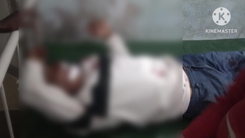 রঘুনাথপুর ২: মন্ডপডাঙ্গা গ্রামের কাছে সাইকেল আরোহীকে বাঁচাতে গিয়ে মোটর বাইক দুর্ঘটনায় গুরুতর আহত মোটর বাইক চালক