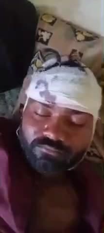 मारवाड़ जंक्शन: मारवाड़जंक्शन के जानुदा गांव में खेत में काम कर रहे युवक पर हमला, एक हमलावर गिरफ्तार, घायल को पाली रेफर किया गया