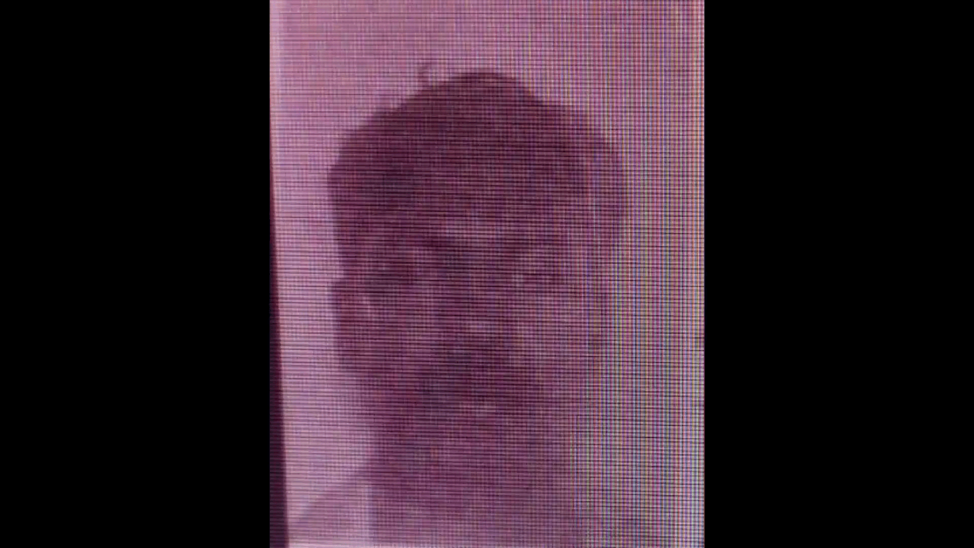 ദേവികുളം: ദേശീയപാതയിൽ അടിമാലി വള്ളപ്പടിക്ക് സമീപം ലോറിയും സ്കൂട്ടറും കൂട്ടിയിടിച്ച് അപകടം, ഒരാൾ മരിച്ചു