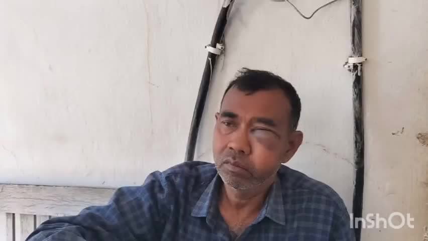 मनिका: मनिका में ज़मीन विवाद में मारपीट, तीन लोग गंभीर रूप से घायल