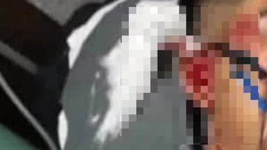 মন্দিরবাজার: মন্দিরবাজারের গাববেরিয়া এলাকায় একটি বাইক নিয়ন্ত্রণ হারিয়ে গাছে ধাক্কা মেরে আহত বাইক আরোহী