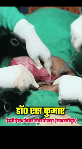 बाबा की नगरी कुशेश्वरस्थान में दो किलोग्राम का रोग निकल गया