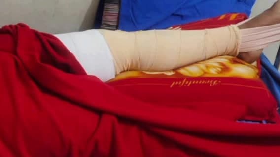মন্দিরবাজার: দয়রামপুর এলাকায় দুটি বাইকের সংঘর্ষে আহত এক বাইক আরোহী