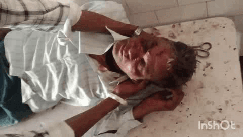 चांदपुर: नूरपुर में मुरादाबाद मार्ग पर मंडेइयो गांव के पास दो बाइकों की टक्कर में पिता-पुत्र गंभीर घायल