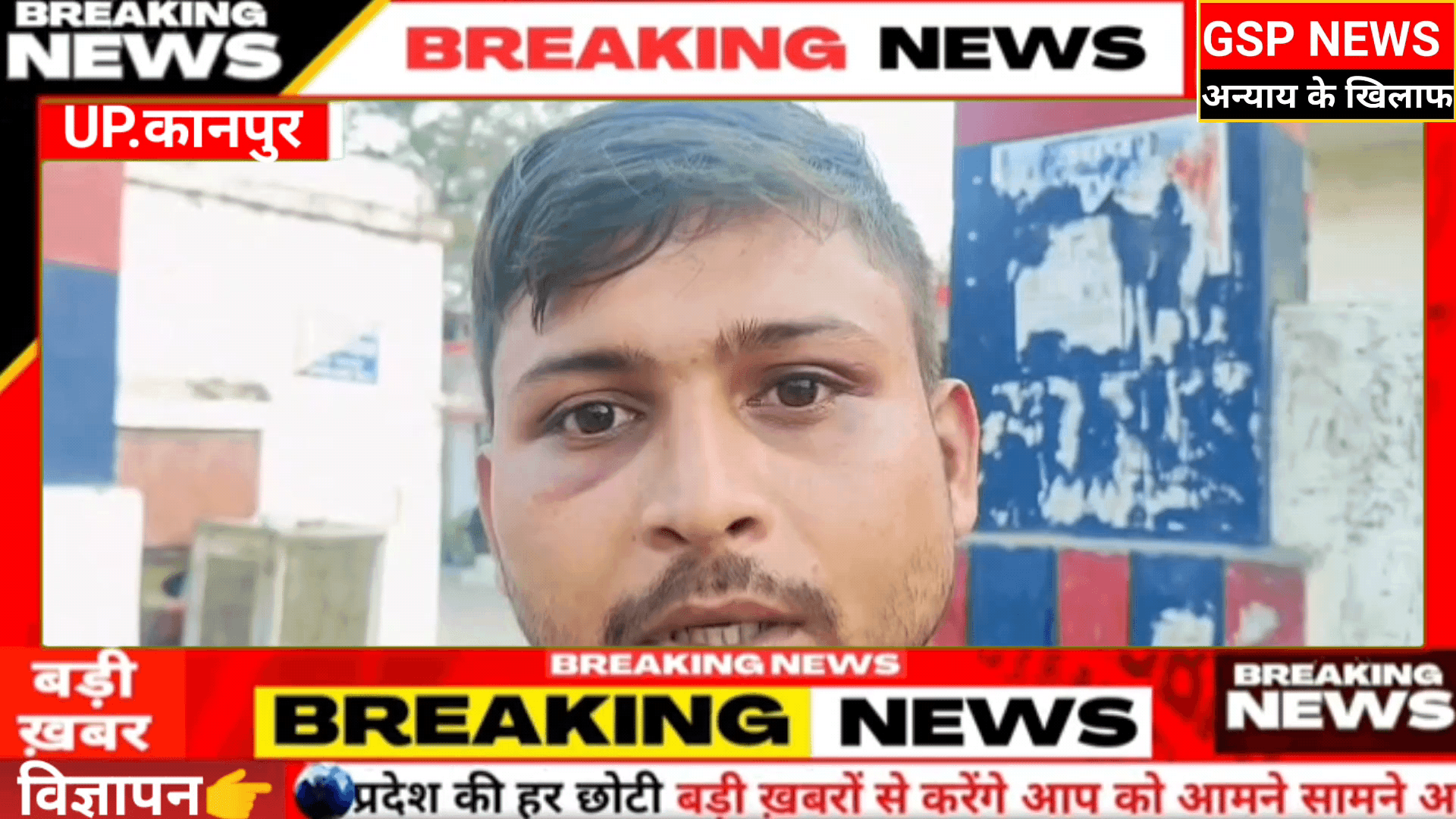 #आरोप#फौजी को पुलिस कर्मियों ने 70 से 80 थप्पड़ मारे#कान का पर्दा फटा#डीसीपी मामले की हो रही है जांच