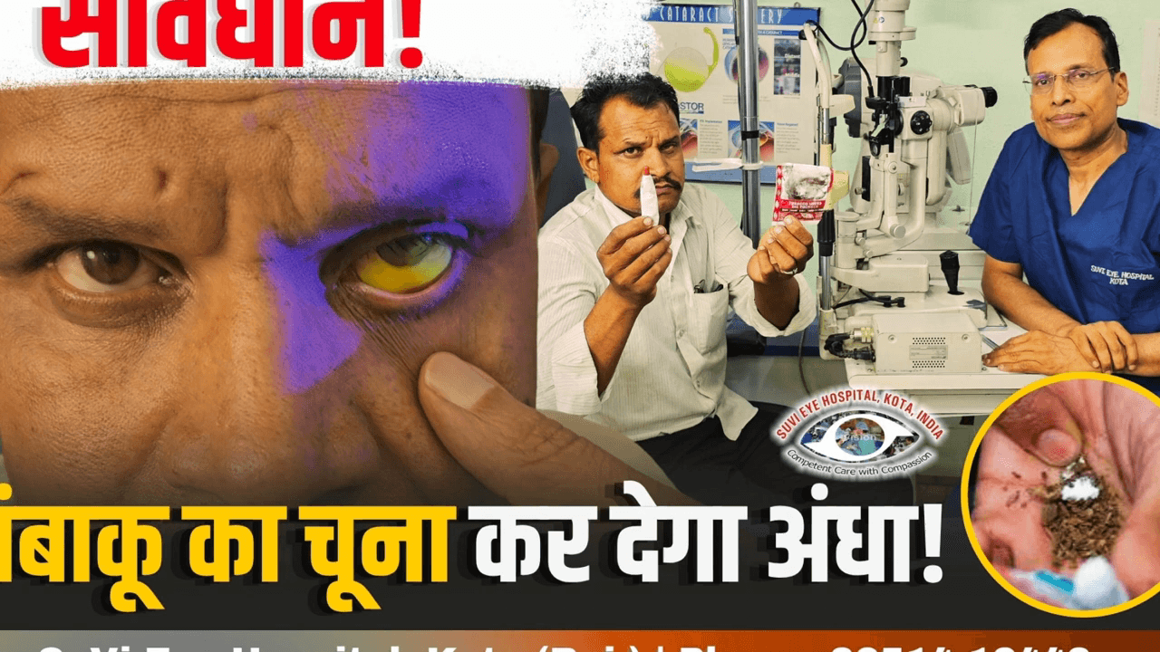 क्या आप भी तंबाकू के साथ चूना खाते हैं? यह वीडियो आपकी आंखें खोल देगा 
#AlkalineEyeBurn #TobaccoHarm #ChunaInEy #DrSureshKPandey #SuViEyeHospital #Kot