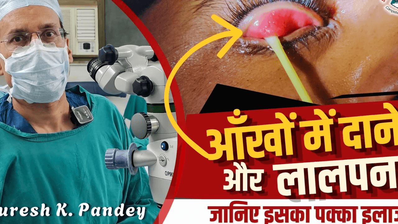 आँखों में दाने और लगातार खुजली? जानिए क्या है यह खतरनाक एलर्जी! | Keratoconjunctivitis Treatment 
#EyeAllergyinSummer #VernalKeratoconjunctivitis #SupratarsalInjectionlive #CobblestonePap