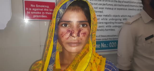 नारखी  के गांव कायथा में एक पुरुष ने एक महिला को मामूली बात पर पीट दिया जिससे महिला को गंभीर चोट आई है