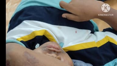 बानो: महाबुआंग मारंगढा के पास स्कूटी और टेम्पो की टक्कर में तीन लोग घायल
