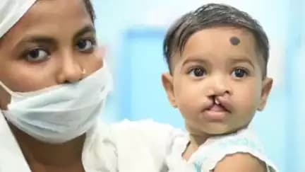 IndianOil is bringing back the smile of children through free Cleft surgeries in Assam, Ranchi and Meghalaya. <nis:link nis:type=tag nis:id=Smile nis:value=Smile nis:enabled=true nis:link/>