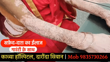 अधौरा: सिवान जिले के काव्या हॉस्पिटल में सफेद दाग का गारंटी के साथ हो रहा है इलाज, दवा का असर नहीं तो पैसा वापस | 9835730266