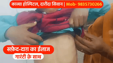 इटावा: सिवान जिले के काव्या हॉस्पिटल में सफेद दाग का गारंटी के साथ हो रहा है इलाज, दवा का असर नहीं तो पैसा वापस | 9835730266